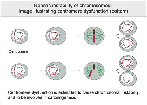 Genetic instability of chromosomes: Image illustrating centromere dysfunction (bottom)