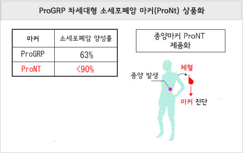 ProGRP 차세대형 소세포폐암 마커(ProNt) 상품화